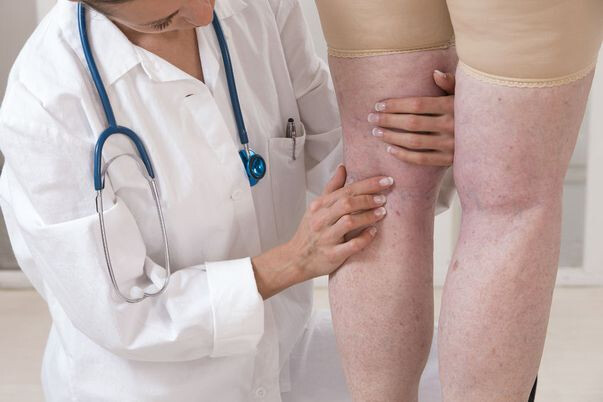 Ce injecții ajută cu varicele picioarelor - avantajele și dezavantajele procedurii?
